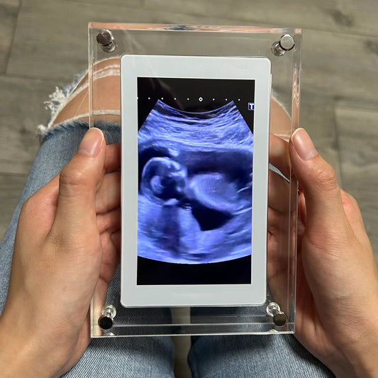 Soulyne Digital Frame